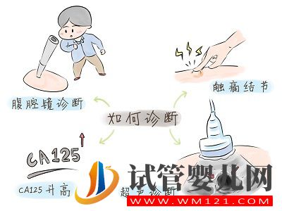 子宫内膜异位症——痛经的一种常见病因(图4)