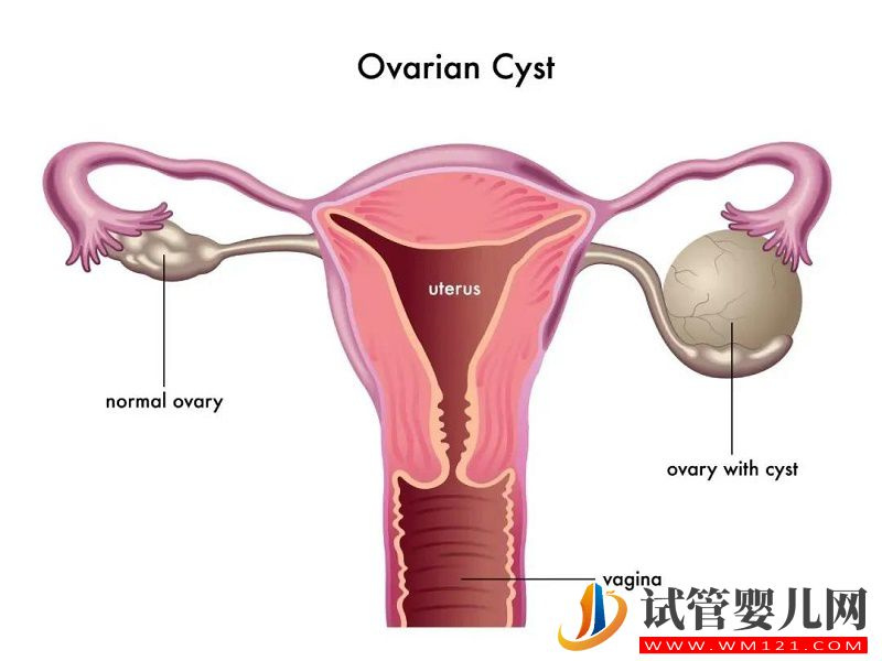 卵巢出现异常会对女性造成什么影响？