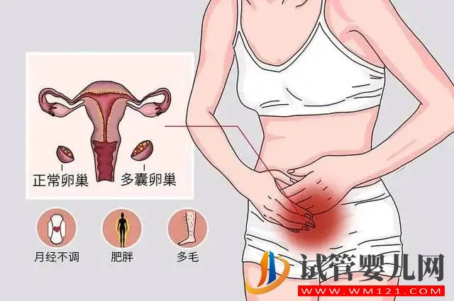多囊卵巢的危害有哪些(图1)