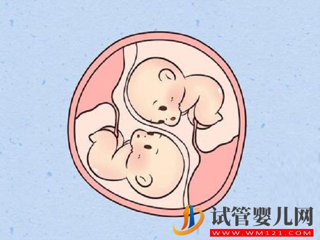 怀双胎可以减胎