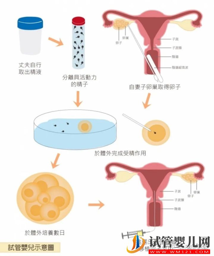 一篇文章看懂辅助生殖(图4)