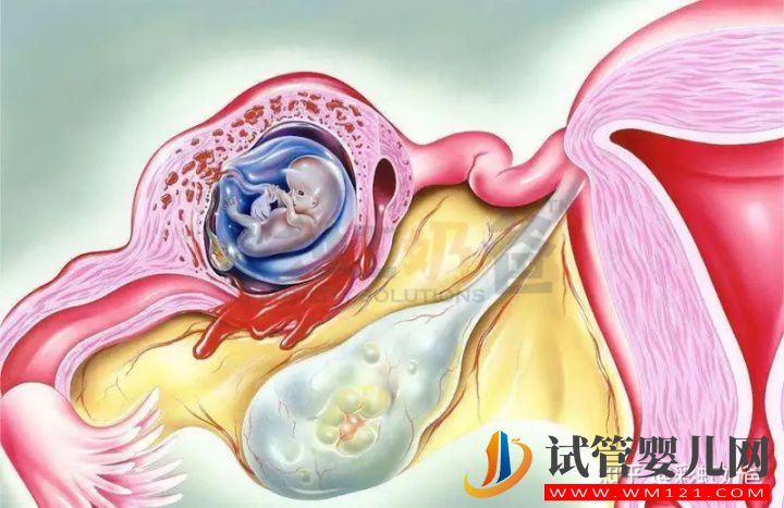 养囊有什么好处_哪些情况推荐养囊(图1)