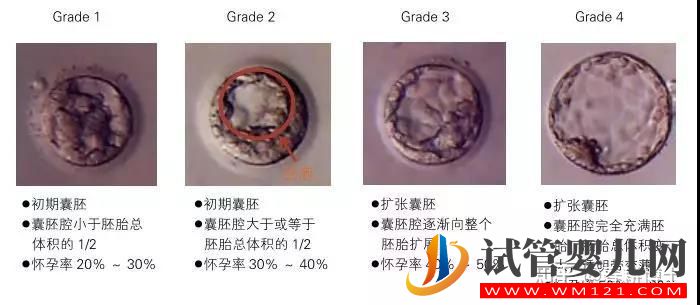 要不要养囊胚,如何提高养囊成功率(图1)