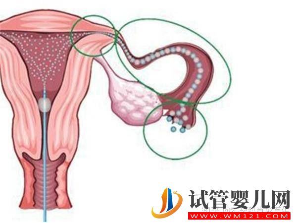 输卵管最容易堵塞的部位,不得不防(图3)