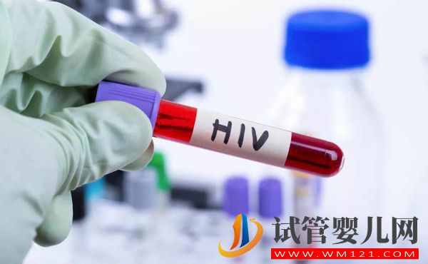 hiv患者一般不能生育