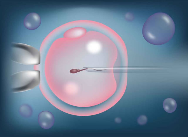 卵子冷冻和体外受精可延缓生殖衰老过程