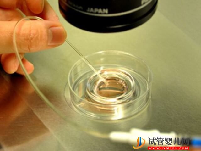 和田做二代试管胚胎移植成功率为45%