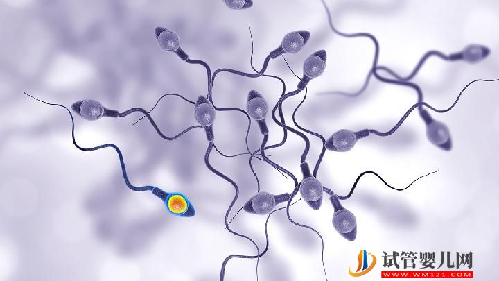 男性不育的原因可总结警惕生活中有这6大精子杀手