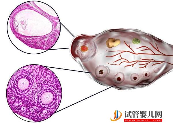 去老挝做试管婴儿过程痛苦吗？