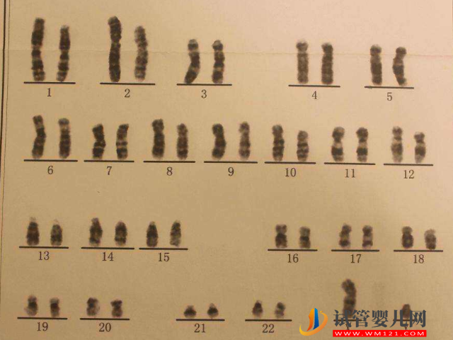 人体内已经是有23对染色体